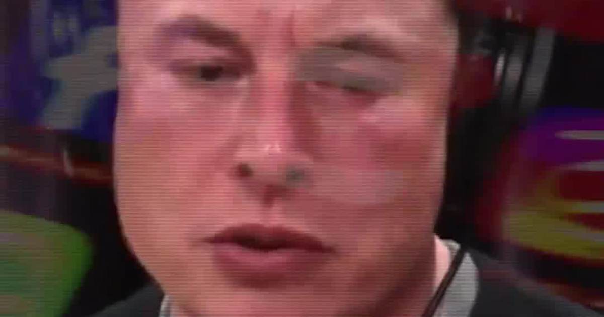 Elon Musk Once Exposed the Social Media Illusion: Why Comparison is Killing Your Happiness